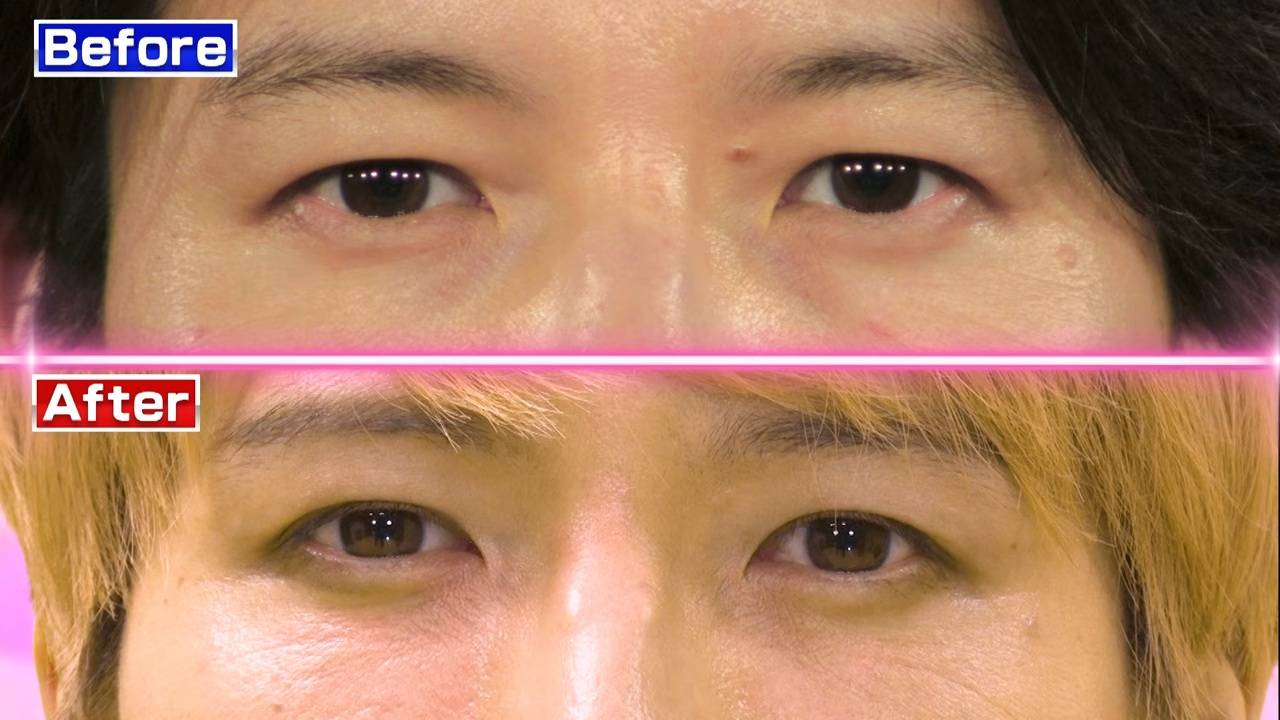 整形が話題に