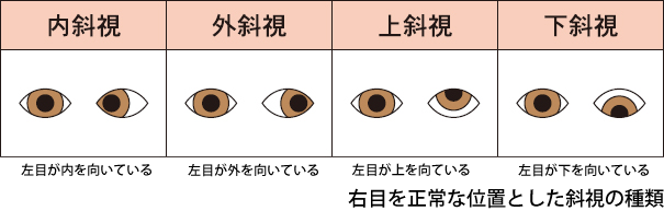 山p 山下智久の目の斜視疑惑まとめ 現在は手術して完治って本当 Kyun Kyun キュンキュン 女子が気になるエンタメ情報まとめ