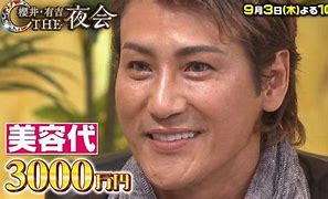 美容代は3000万円