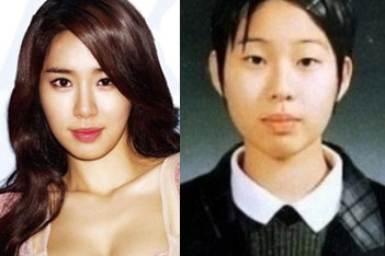 韓国女優の整形 ビフォーアフター画像 成功例と失敗例を総まとめ Kyun Kyun キュンキュン 女子が気になるエンタメ情報まとめ