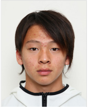 平野歩夢は一重だった？