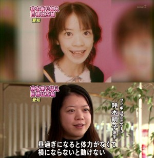 拒食症の鈴木明子の顔が歯の矯正で変わった かわいい画像も Kyun Kyun キュンキュン 女子が気になるエンタメ情報まとめ