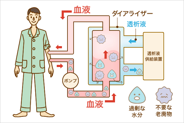 人工透析とは